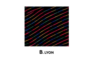 Καλυμματα Σετ Βελουδα B